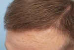 Farjo Hair Institute3.jpg