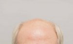 Farjo Hair Institute7.jpeg