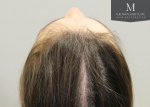 The Maitland Clinic Review17_Before_behind_above_close-up.jpg
