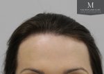 The Maitland Clinic Review20_After_Front.jpg