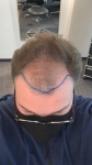 Pre Op.jpg