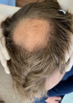 Crown before.JPG