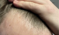 Hairline.jpg