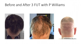 Before and After.PNG