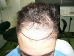 beforefront.jpg