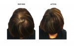 HM B4 & After 080313.jpg