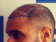 Diamod hair clinic.jpg