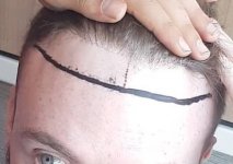 Diamond hair clnic.jpg