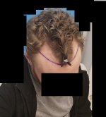 Before Op.jpg