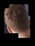 Donor Before.jpg