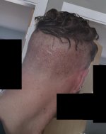 Day 2 donor 2.jpg