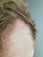 Week 11 temple growth2.jpg