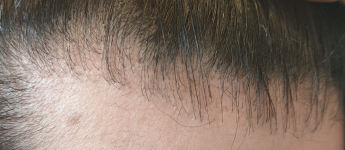 12 months Right cropped.png