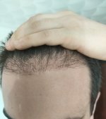 2 months center-left.jpg