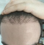 2 months center.jpg