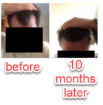 before-after.png