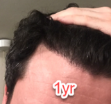 1year-2.png