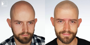 kuba przed i po.png