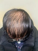 before operation.jpeg