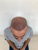 POST OPERATION AFTER WASH.jpeg