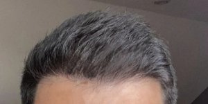 after.jpeg