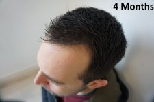 4C.jpg