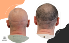mislukte ht 2 (550 x 350 px) (550 x 350 px).png