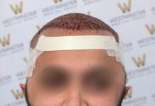 WMG FUE Pot Op.jpg
