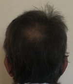 17.5 months_5502.JPG