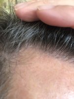 17.5 months_5517.JPG