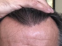 17.5 months_5521.JPG