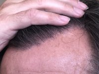 17.5 months_5527.JPG