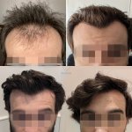 X4_GV-0_12MONTHS.jpg