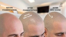 voorbeeld anti shine zero shine.jpg