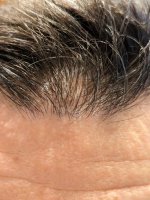 hairline.jpg hairline.jpg