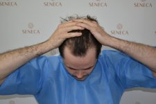 thumbnail_BEFORE (5).jpg