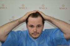 thumbnail_BEFORE (4).jpg