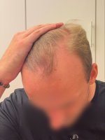 Oben_links_gezogen-min.jpg