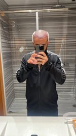 Hair Transplant 1.jpg