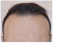 6month_frontview.jpg