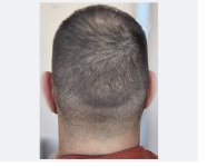 6month_rearview.jpg