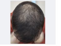 6month_topview.jpg