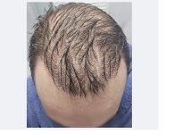6month_wet_topview.jpg