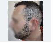 ok6month_sideview1.jpg