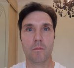 Full face pre treatment (2).JPG
