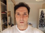 2 Days Post Op 18-05-16.JPG