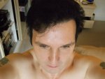 9 Days Post Op Full Face 25-05-16.JPG
