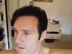 9 Days Post Op Left Side 25-05-16.JPG