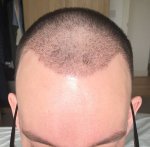 Forum11Days2.jpg