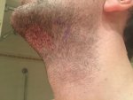 Beard Donor 03.jpg